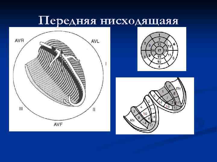 Передняя нисходящаяя 