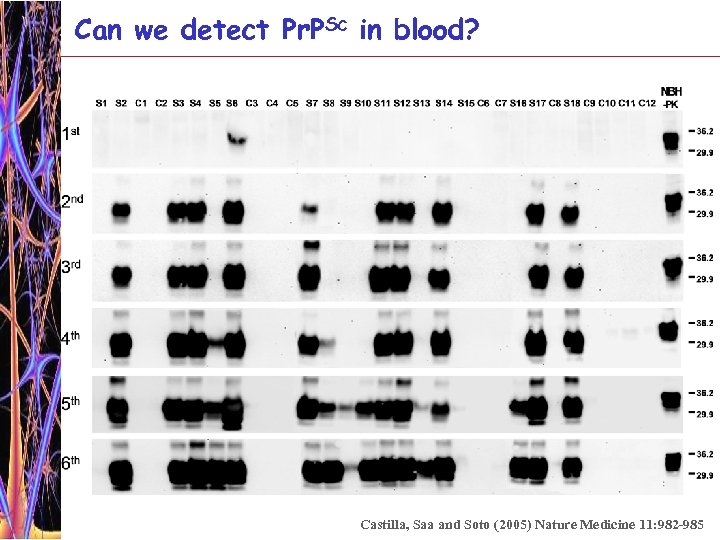 Can we detect Pr. PSc in blood? Castilla, Saa and Soto (2005) Nature Medicine