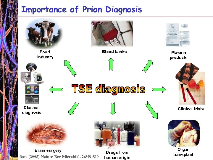 Importance of Prion Diagnosis Food industry Blood banks Disease diagnosis Brain surgery Soto (2005)