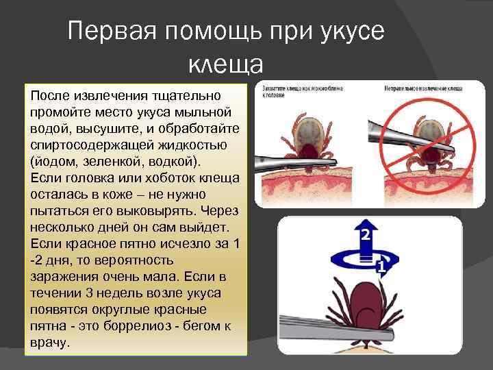 Первая помощь при укусе клеща Необходимо захватить клеща как После извлечения тщательно можно ближе