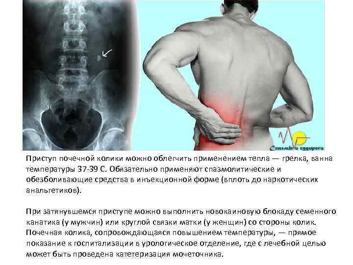 Приступ почечной колики можно облегчить применением тепла — грелка, ванна температуры 37 -39 С.