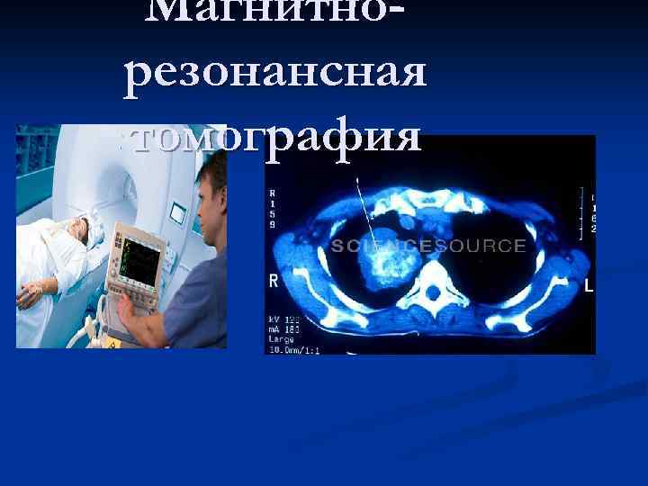 Магнитнорезонансная томография 