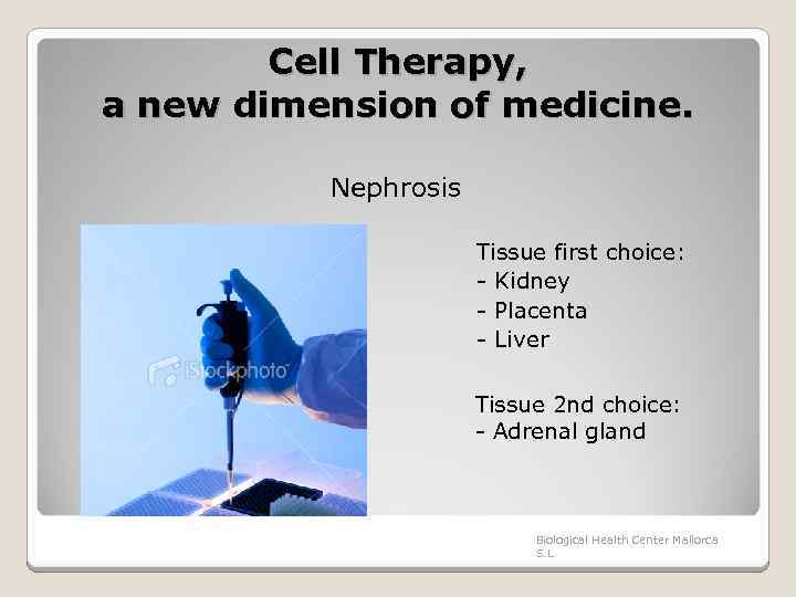 Cell Therapy, a new dimension of medicine. Nephrosis Tissue first choice: - Kidney -