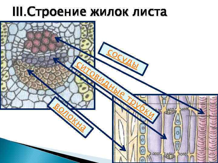 III. Строение жилок листа си со то во ло кн а ви суд ы