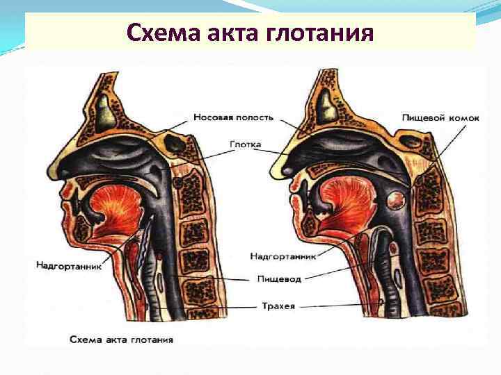 Полипы в ротовой полости фото