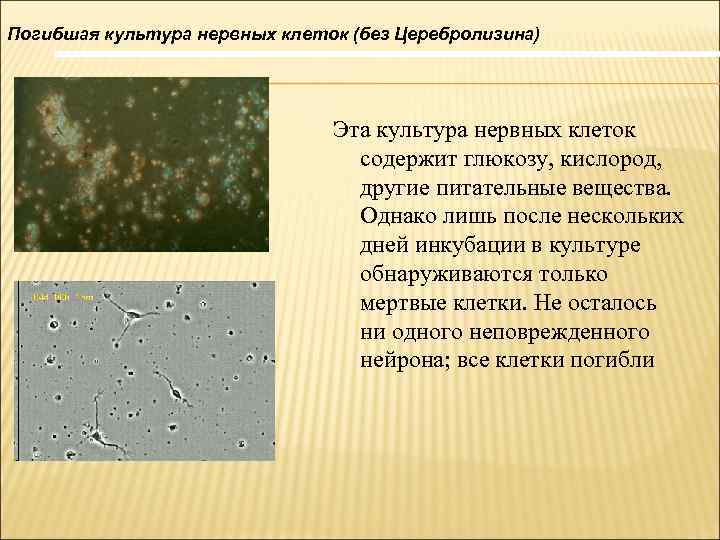 Погибшая культура нервных клеток (без Церебролизина) Эта культура нервных клеток содержит глюкозу, кислород, другие