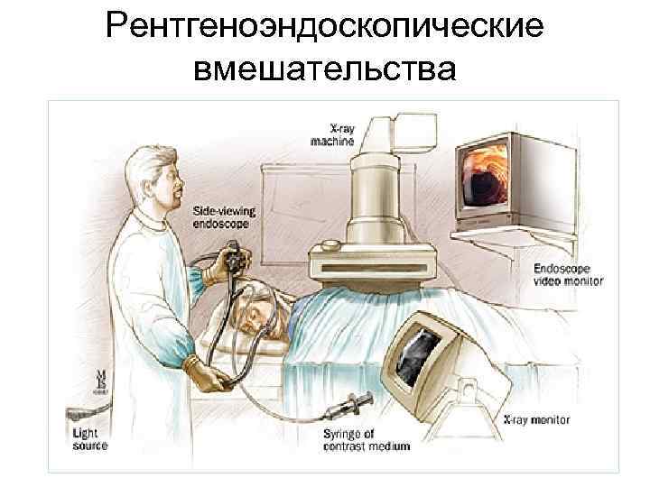 Рентгеноэндоскопические вмешательства 11 
