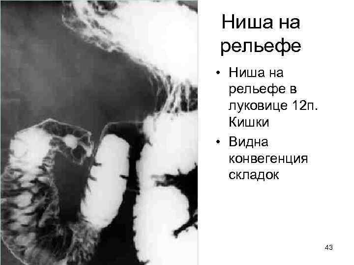 Ниша на рельефе • Ниша на рельефе в луковице 12 п. Кишки • Видна