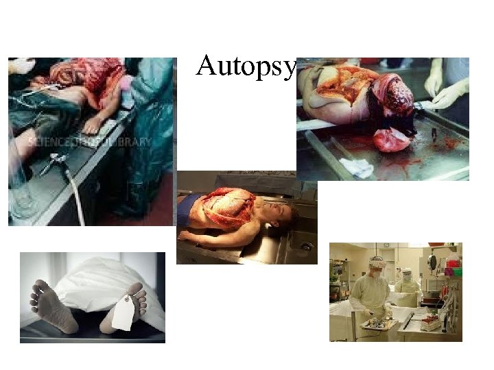 Autopsy 