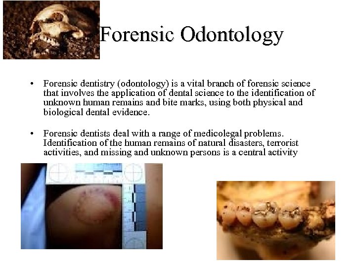  Forensic Odontology • Forensic dentistry (odontology) is a vital branch of forensic science