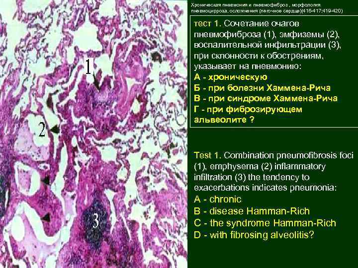 Хроническая пневмония. Пневмофиброз морфология. Морфология пневмофиброза патанатомия. Хроническая пневмония морфология.