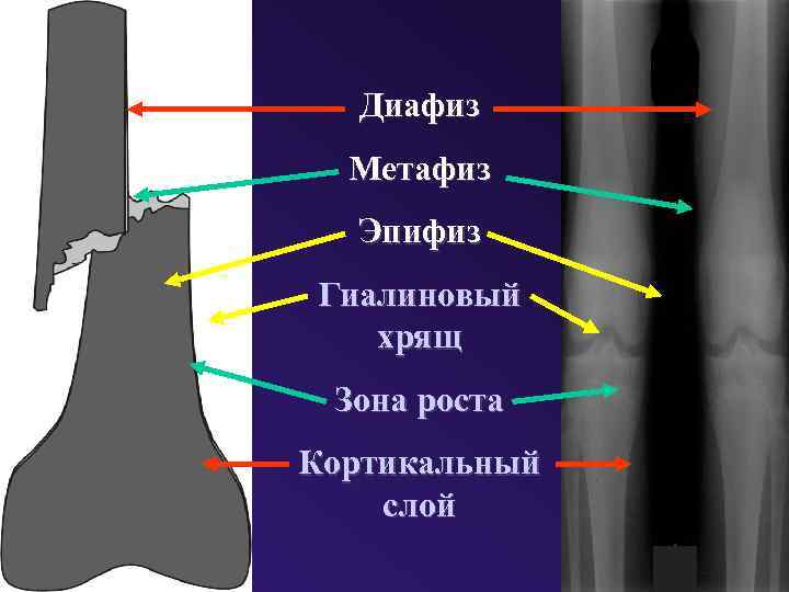 Диафиз Метафиз Эпифиз Гиалиновый хрящ Зона роста Кортикальный слой 