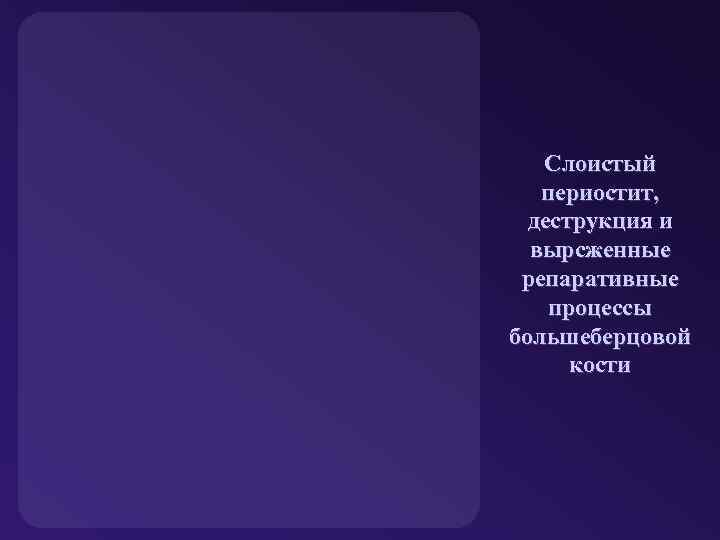 Слоистый периостит, деструкция и вырсженные репаративные процессы большеберцовой кости 