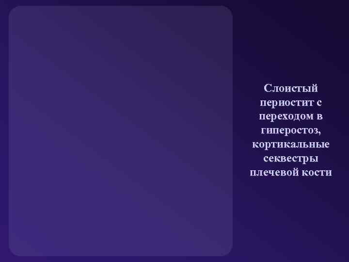 Слоистый периостит с переходом в гиперостоз, кортикальные секвестры плечевой кости 