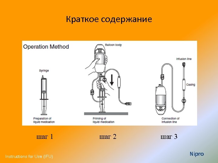 Инфузия задание 4 4. Система SUREFUSER. Схема установки порта для внутривенных инфузий. Нипро помпы. Презентация на тему инфузия.