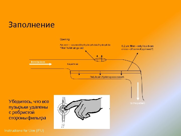 Воспользуйтесь текстом инфузия расположенным выше