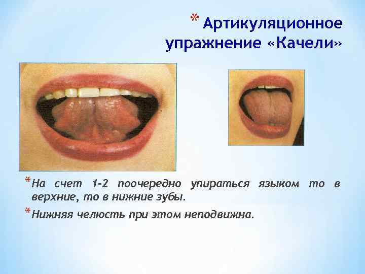 * Артикуляционное упражнение «Качели» *На счет 1 -2 поочередно упираться языком то в верхние,