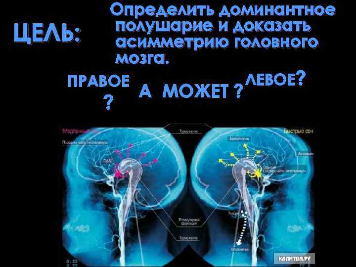 ЦЕЛЬ: Определить доминантное полушарие и доказать асимметрию головного мозга. ПРАВОЕ ? А МОЖЕТ ?