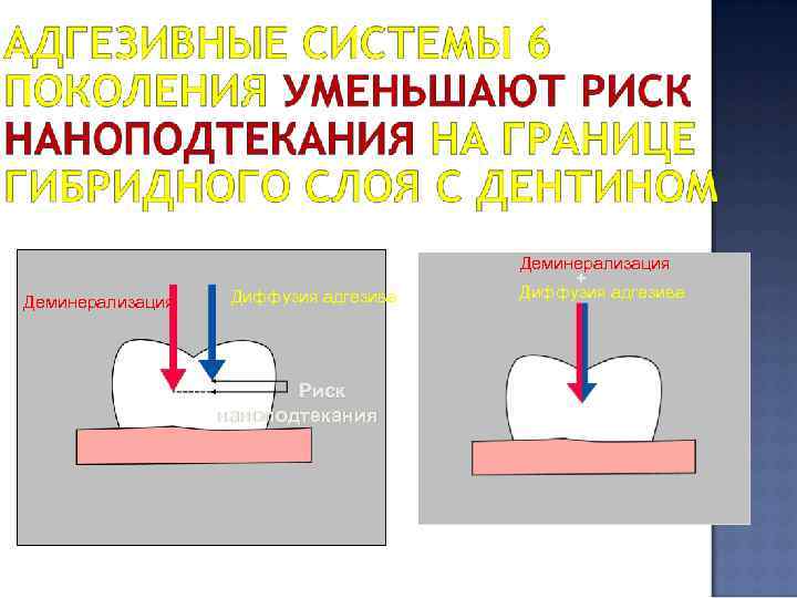 Деминерализация Диффузия адгезива Риск наноподтекания Деминерализация + Диффузия адгезива 