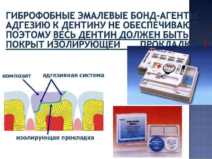 композит адгезивная система изолирующая прокладка 