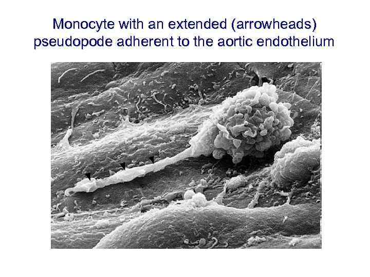 Monocyte with an extended (arrowheads) pseudopode adherent to the aortic endothelium 