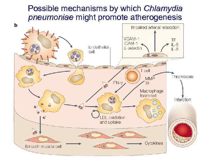 Possible mechanisms by which Chlamydia pneumoniae might promote atherogenesis 