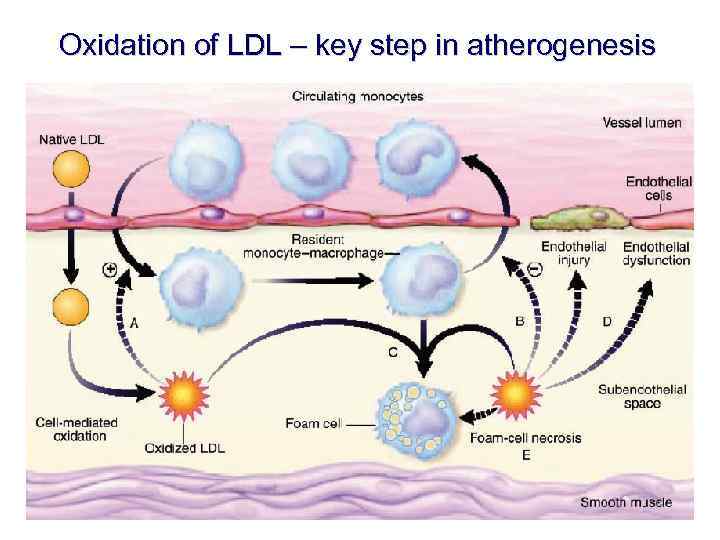 Oxidation of LDL – key step in atherogenesis 