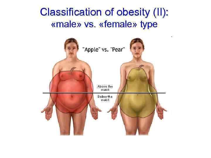 Classification of obesity (II): «male» vs. «female» type 