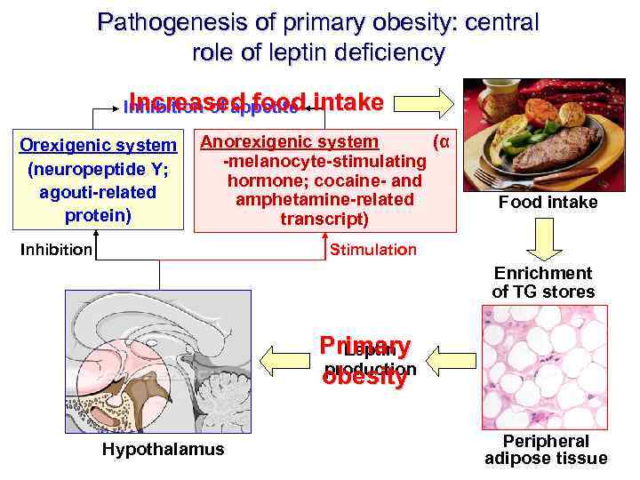 Pathogenesis of primary obesity: central role of leptin deficiency Increased food Inhibition of appetite