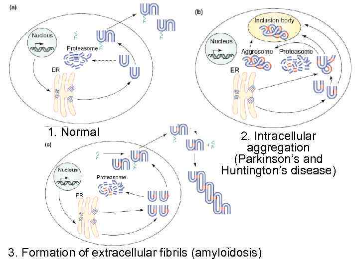 1. Normal 2. Intracellular aggregation (Parkinson’s and Huntington’s disease) 3. Formation of extracellular fibrils