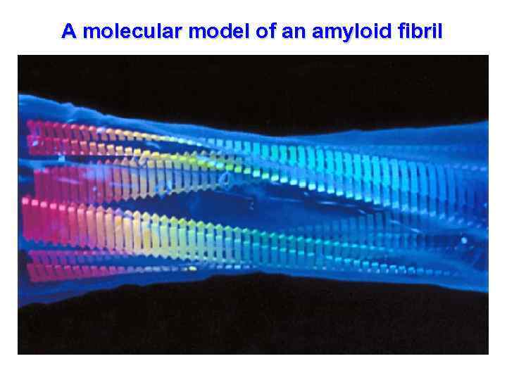 A molecular model of an amyloid fibril 