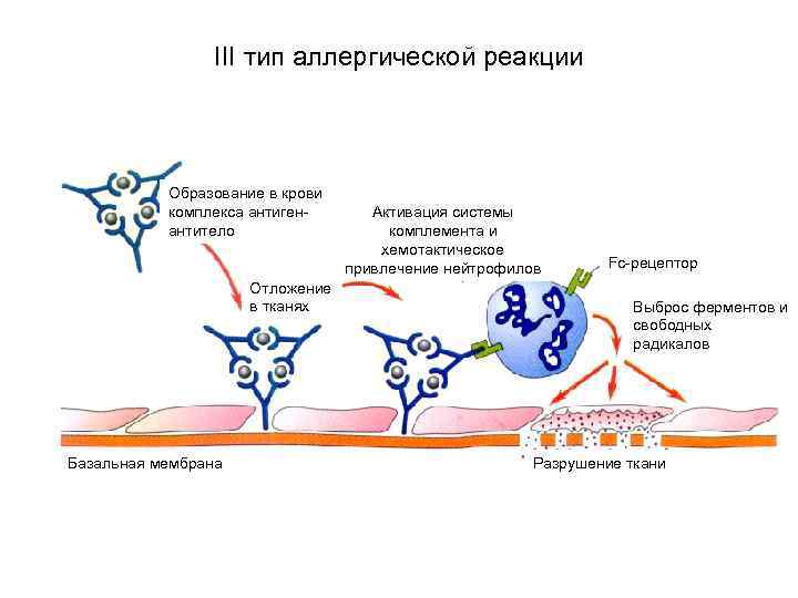 III тип аллергической реакции Образование в крови комплекса антигенантитело Отложение в тканях Базальная мембрана