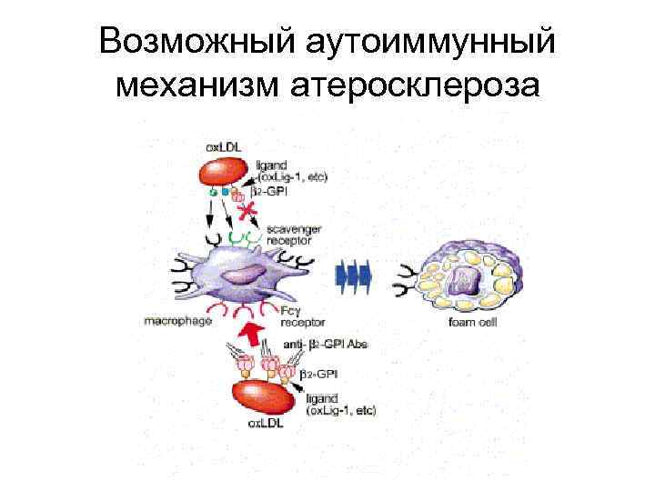 Возможный аутоиммунный механизм атеросклероза 