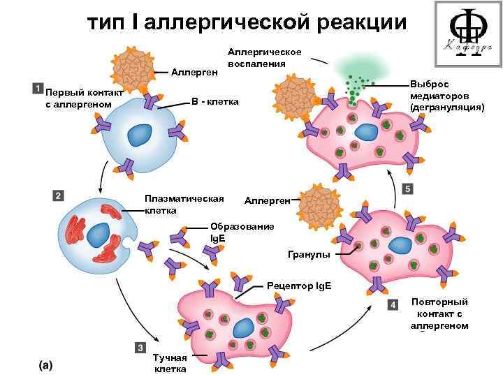тип I аллергической реакции Аллерген Первый контакт с аллергеном Аллергическое воспаления Выброс медиаторов (дегрануляция)