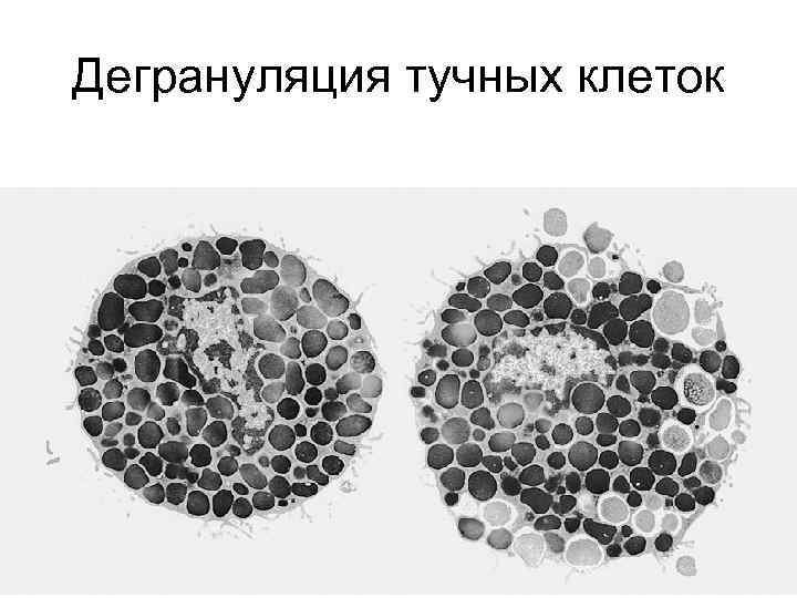 Дегрануляция тучных клеток 