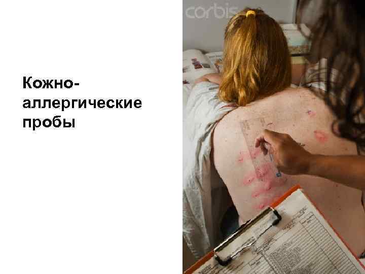 Кожноаллергические пробы 