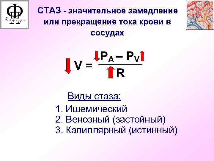 СТАЗ - значительное замедление или прекращение тока крови в сосудах Виды стаза: 1. Ишемический