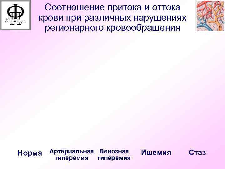 Соотношение притока и оттока крови при различных нарушениях регионарного кровообращения Норма Артериальная Венозная гиперемия