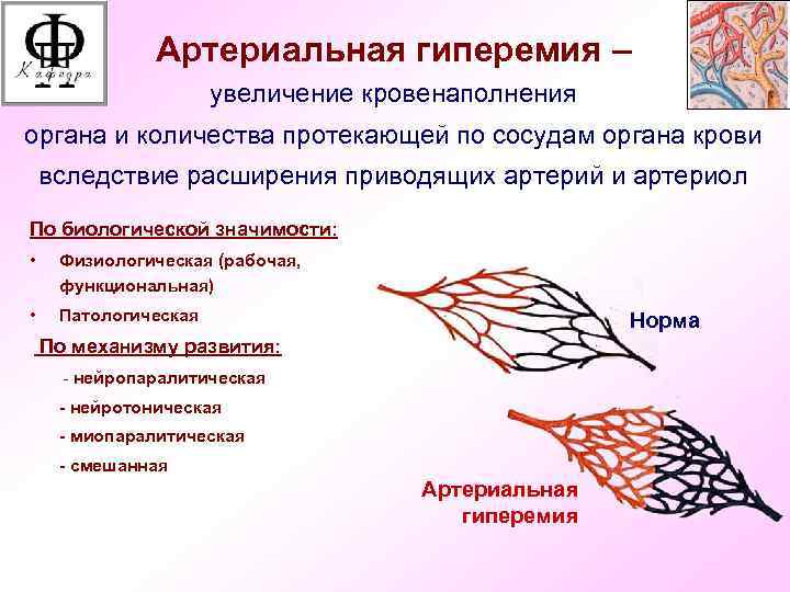 Признаки артериального кровообращения. Схема развития артериальной гиперемии. Причины артериальной гиперемии патофизиология. Морфологические проявления артериальной гиперемии. Механизмы развития артериальной гиперемии патофизиология.