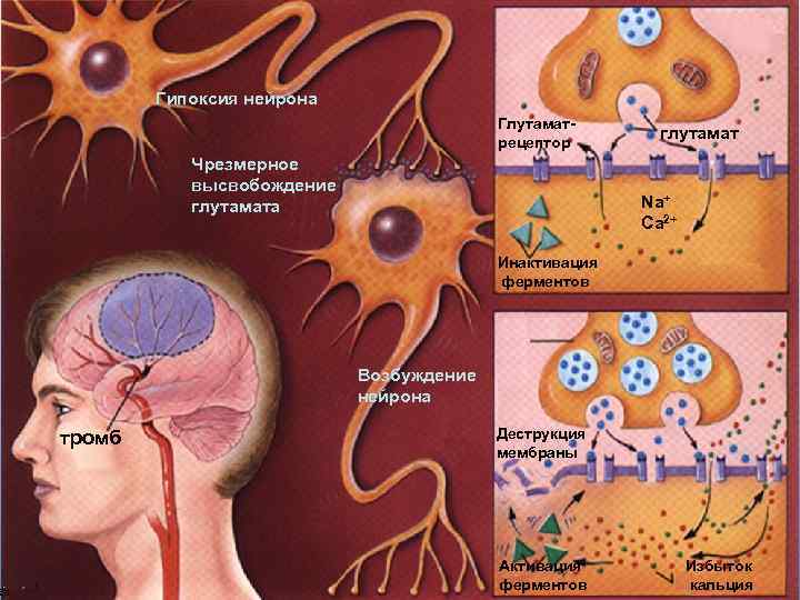 Гипоксия нейрона Глутаматрецептор Чрезмерное высвобождение глутамата глутамат Na+ Ca 2+ Инактивация ферментов Возбуждение нейрона