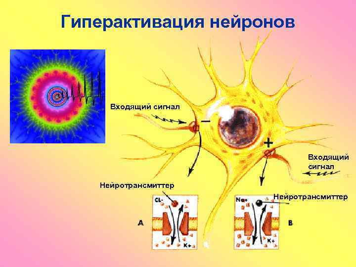 Гиперактивация нейронов Входящий сигнал Нейротрансмиттер 