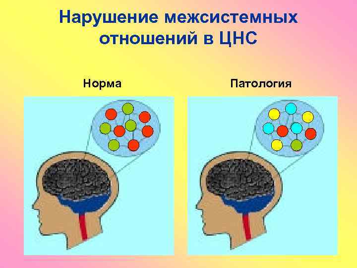 Нарушение межсистемных отношений в ЦНС Норма Патология 