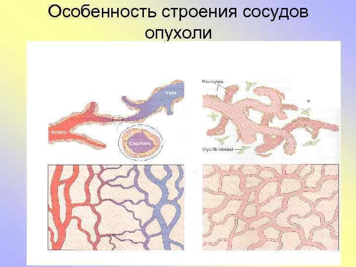 Особенность строения сосудов опухоли 