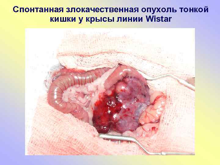 Спонтанная злокачественная опухоль тонкой кишки у крысы линии Wistar 