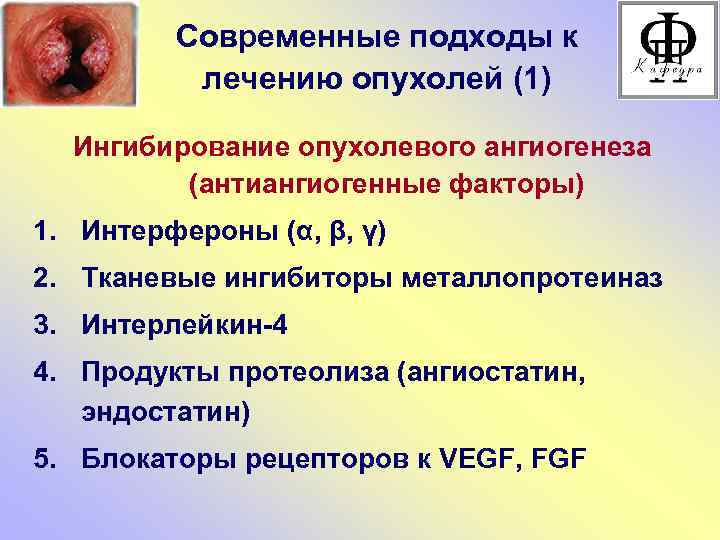 Современные подходы к лечению опухолей (1) Ингибирование опухолевого ангиогенеза (антиангиогенные факторы) 1. Интерфероны (α,