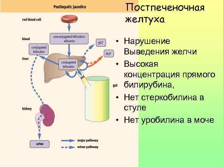 Вызывается обструкцией желчевыводящих путей Plasma bilirubin is conjugated, and other biliary metabolites, such as