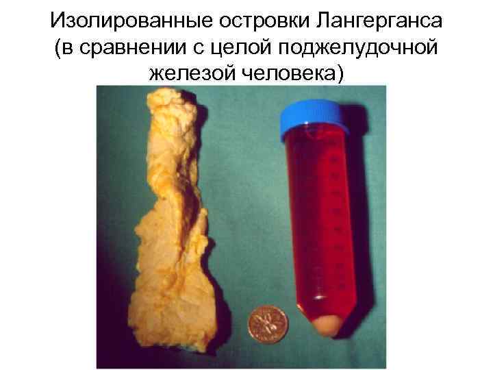 Изолированные островки Лангерганса (в сравнении с целой поджелудочной железой человека) 