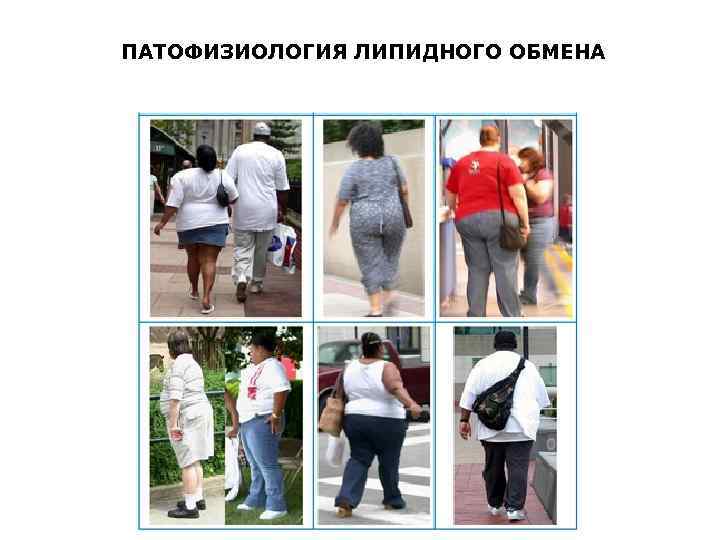 ПАТОФИЗИОЛОГИЯ ЛИПИДНОГО ОБМЕНА 