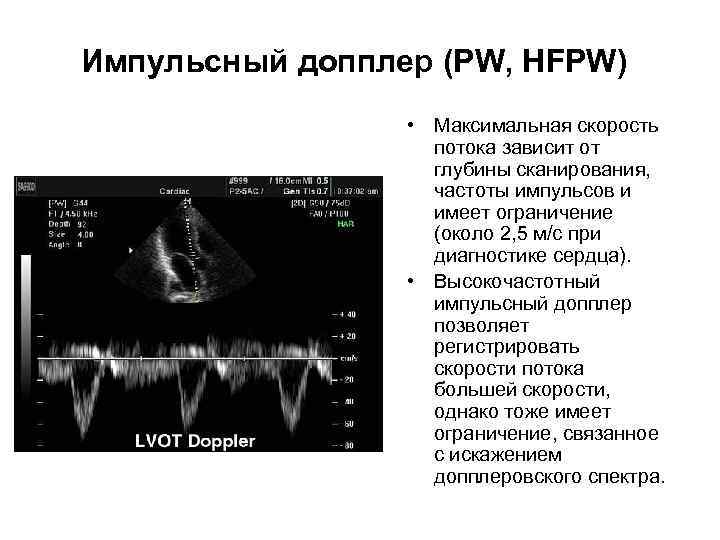 Импульсный допплер (PW, HFPW) • Максимальная скорость потока зависит от глубины сканирования, частоты импульсов