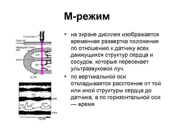  М-режим • на экране дисплея изображается временная развертка положения по отношению к датчику